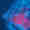 56-Redefining-Care-for-HR-Positive-Metastatic-Breast-Cancer-MEDSCAPE-GLOBAL-ONCOLOGY-thumb